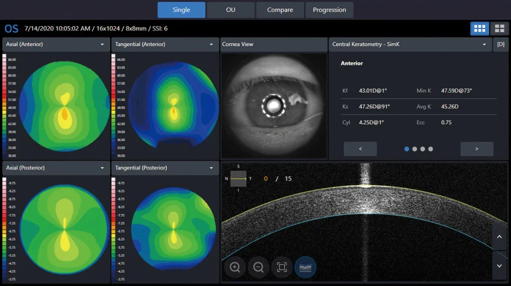 Simplesettingdisplaytopo